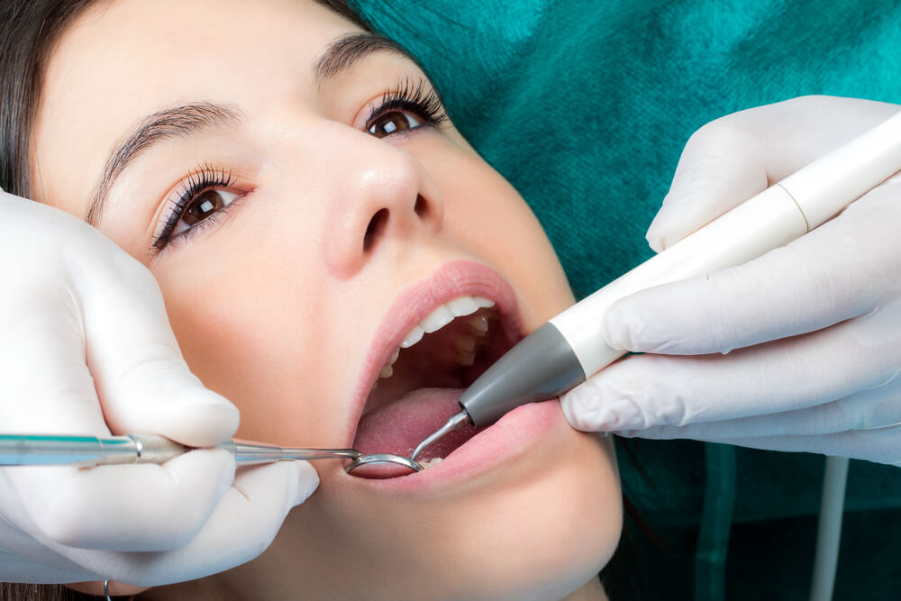 牙周病治療方式：洗牙